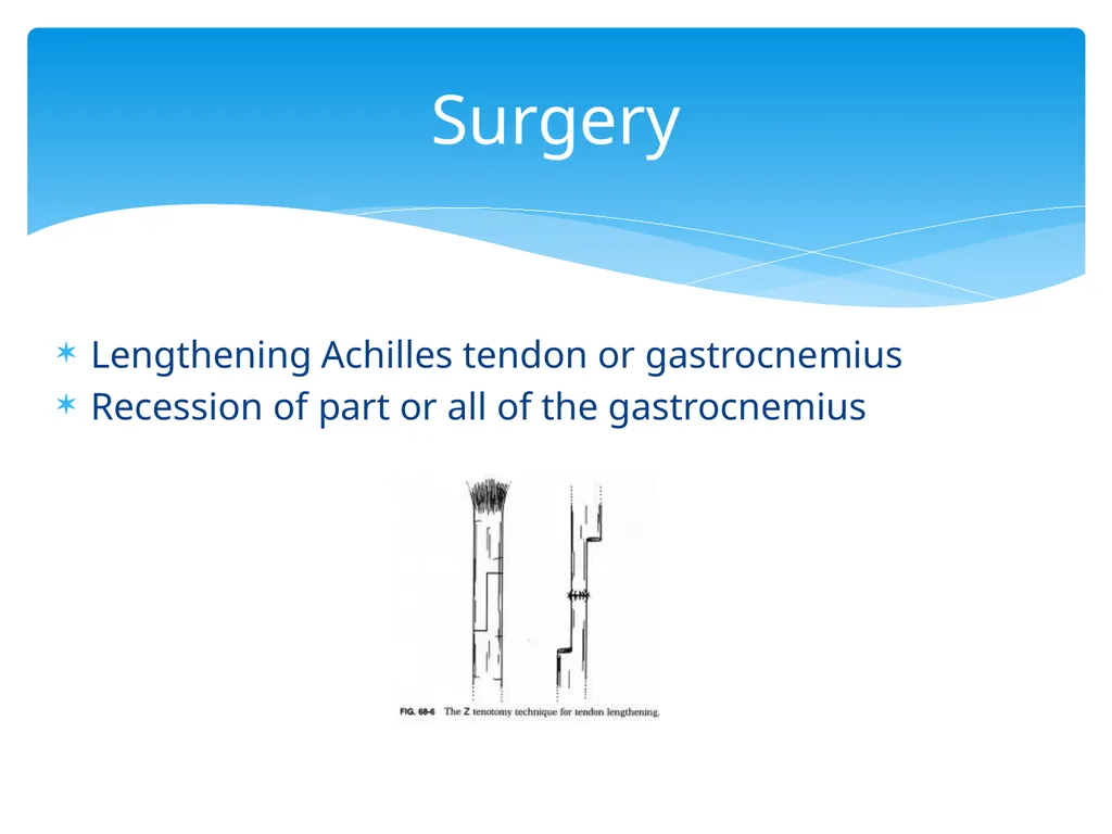 ASD and Toe Walking Christina Lanzone, SPT UNC - slide 22 of 26