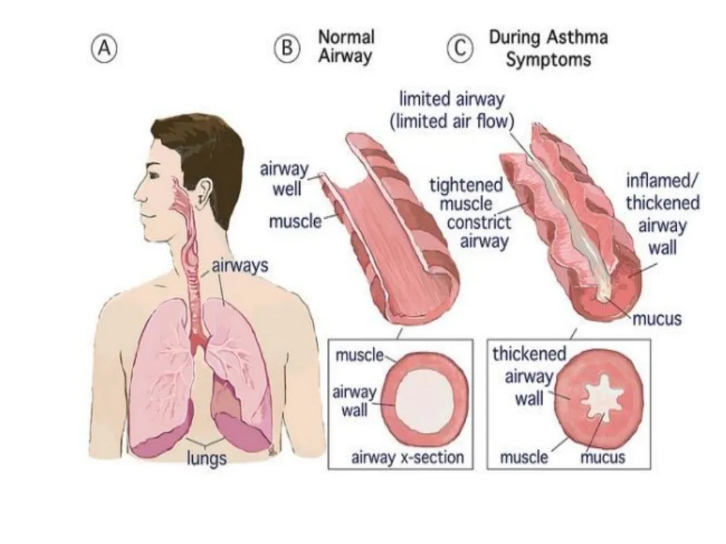 Physiologic Peculiarities of Specific - slide 12 of 12
