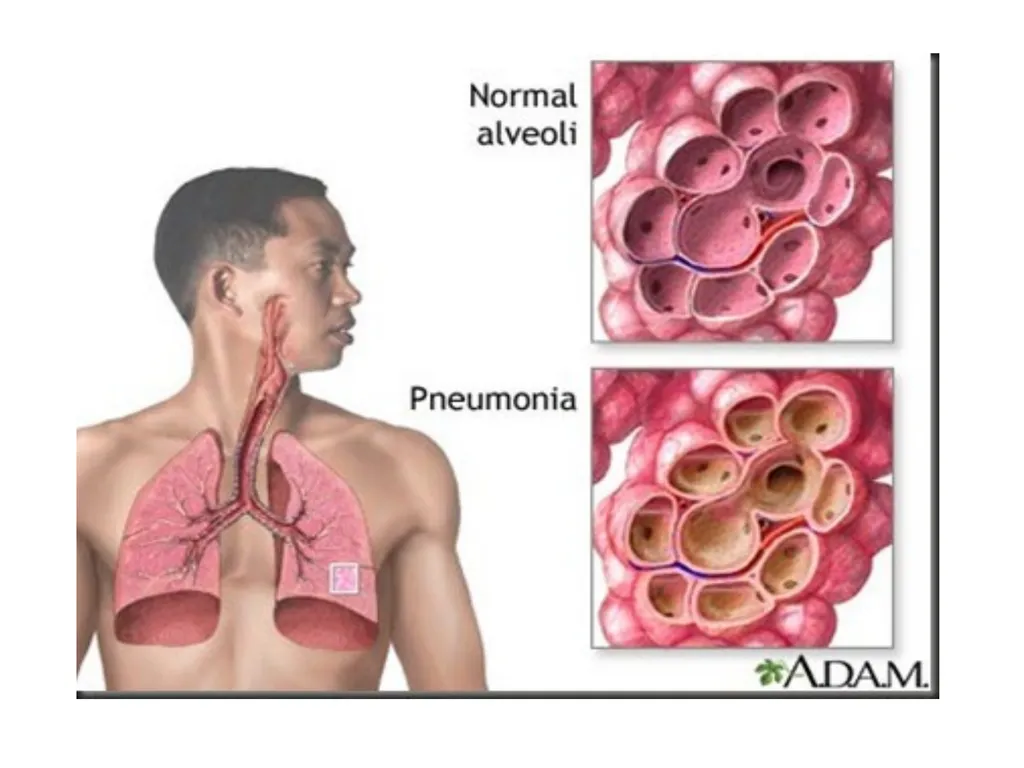 Physiologic Peculiarities of Specific - slide 8 of 12
