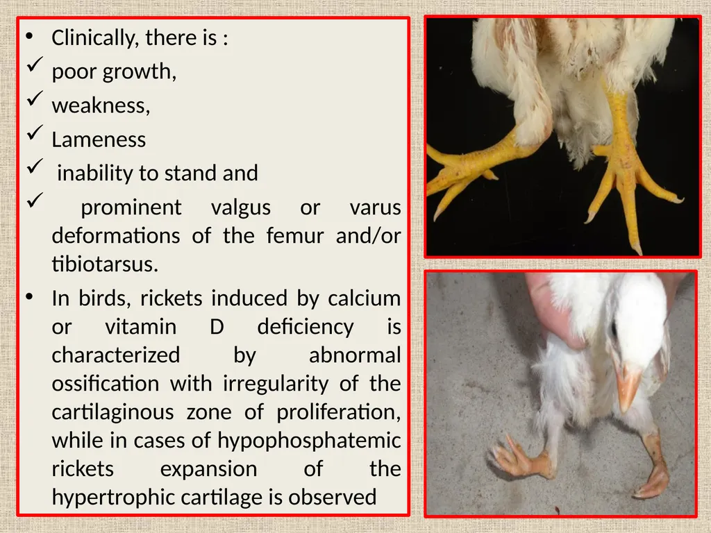 RICKETS VCM-609 Dr. Anil Kumar PG(Medicine) Dept. - slide 11 of 16