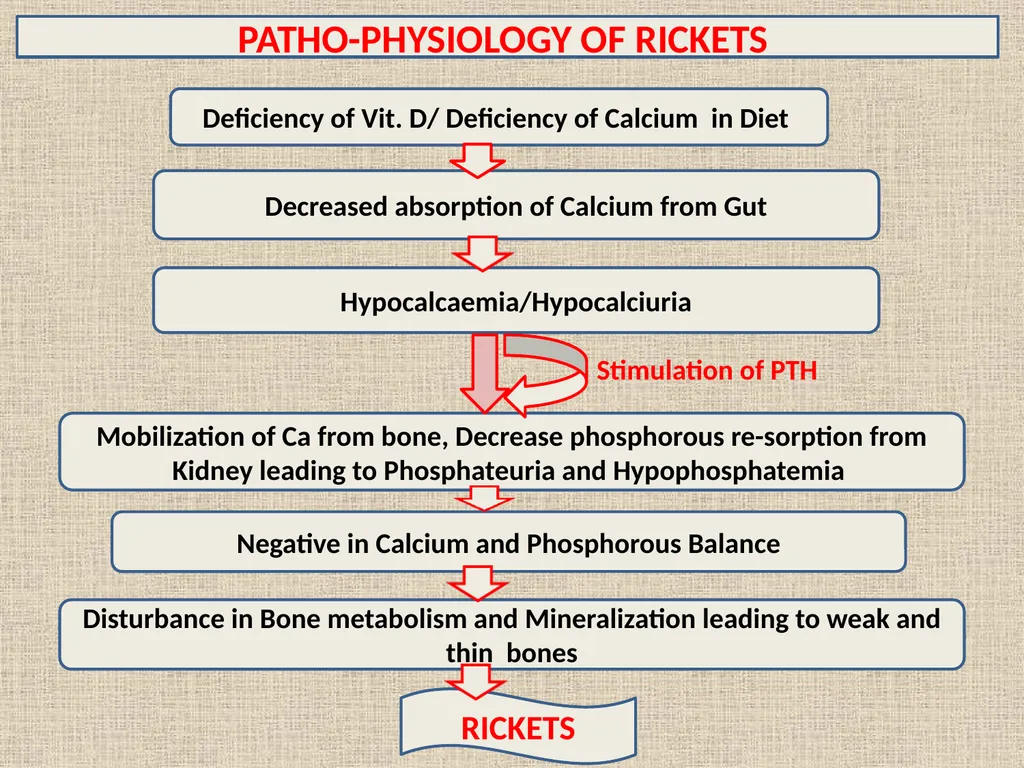 RICKETS VCM-609 Dr. Anil Kumar PG(Medicine) Dept. - slide 7 of 16