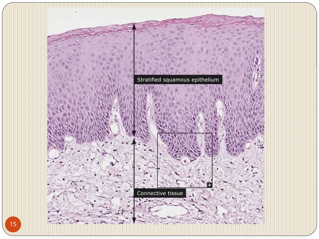 MAHARASHTRA INSTITUTE OF DENTAL SCIENCES AND - slide 15 of 31
