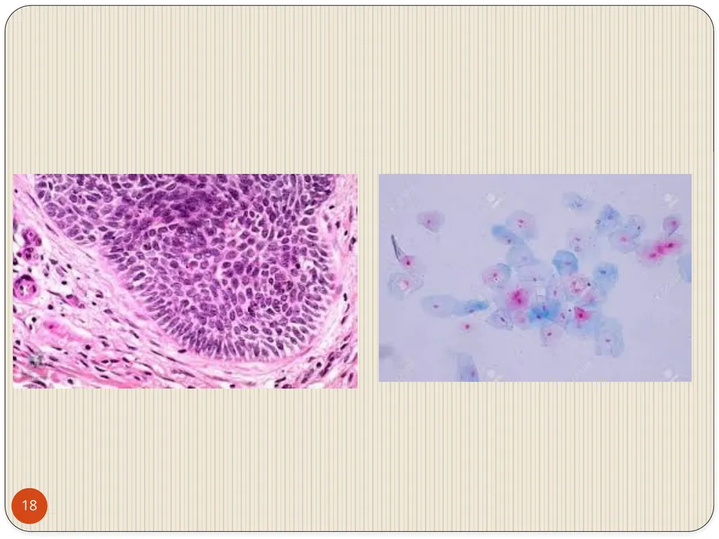 MAHARASHTRA INSTITUTE OF DENTAL SCIENCES AND - slide 18 of 31