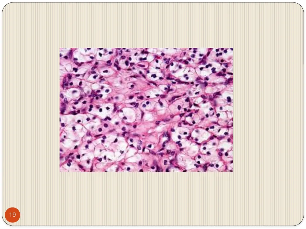 MAHARASHTRA INSTITUTE OF DENTAL SCIENCES AND - slide 19 of 31