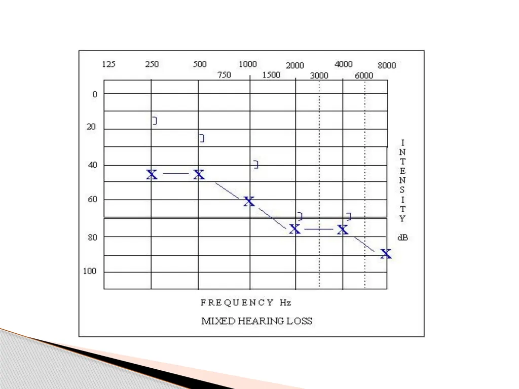 DEAFNESS,,,,,HEARING LOSS Asst.prof dr.FALIH - slide 19 of 48