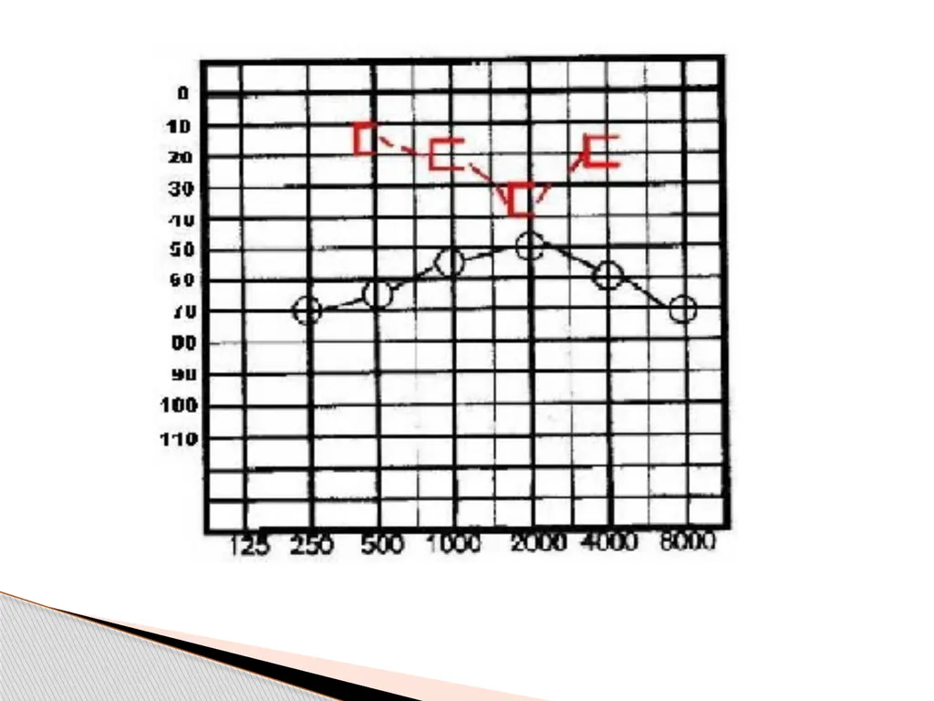 DEAFNESS,,,,,HEARING LOSS Asst.prof dr.FALIH - slide 27 of 48