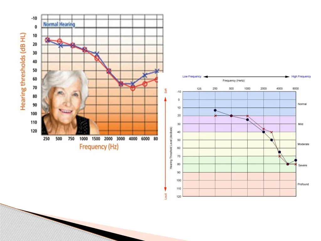 DEAFNESS,,,,,HEARING LOSS Asst.prof dr.FALIH - slide 41 of 48
