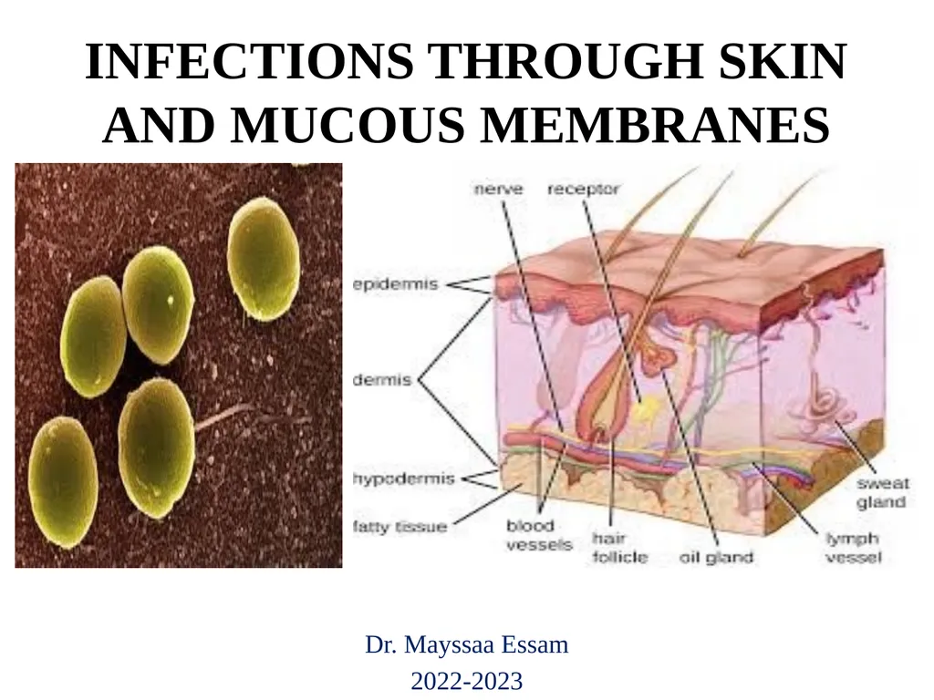 INFECTIONS THROUGH SKIN AND MUCOUS MEMBRANES Dr. - slide 1 of 26