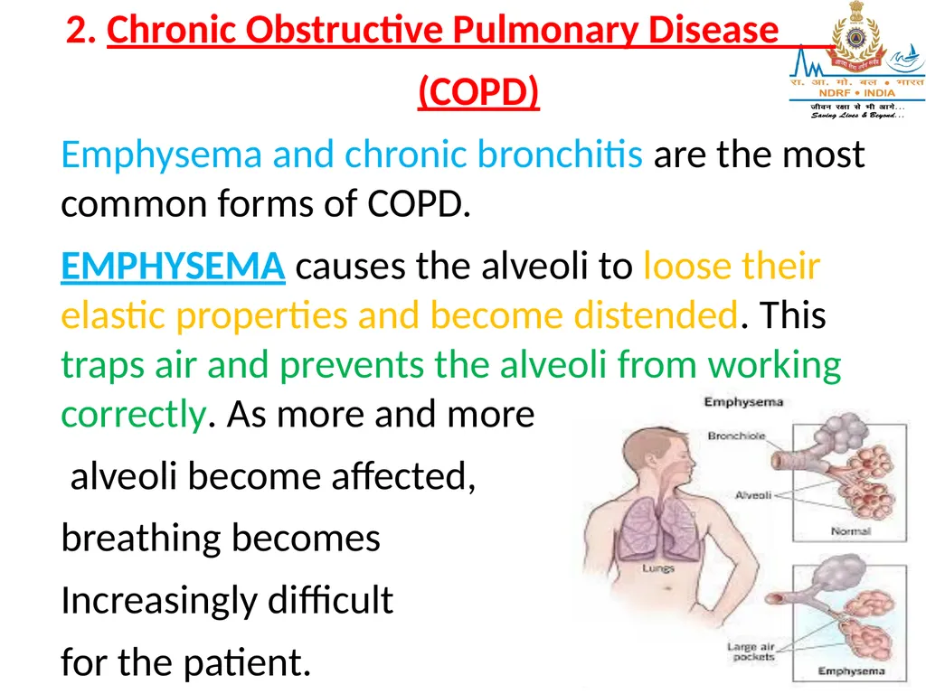 RESPIRATORY EMERGENCIES LESSON-16 BY JITENDER - slide 11 of 43