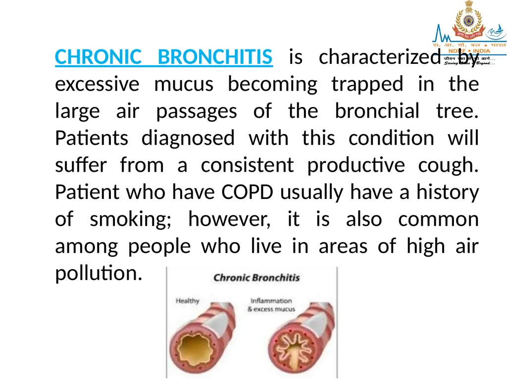 RESPIRATORY EMERGENCIES LESSON-16 BY JITENDER - slide 12 of 43