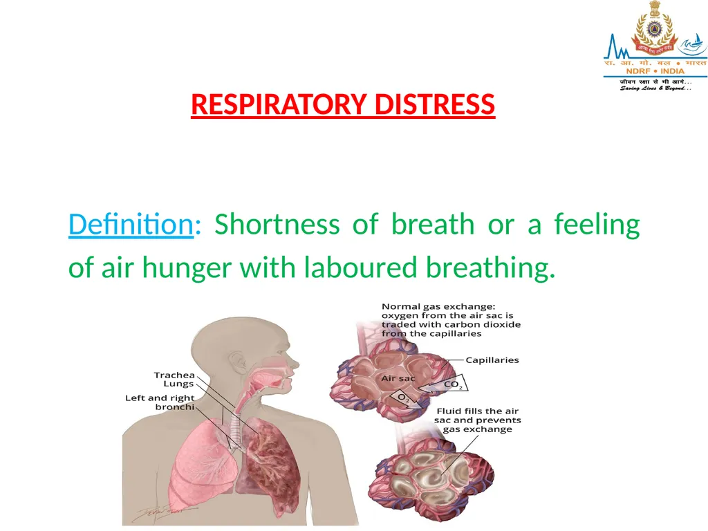 RESPIRATORY EMERGENCIES LESSON-16 BY JITENDER - slide 4 of 43