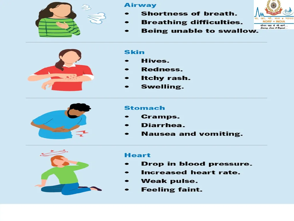 RESPIRATORY EMERGENCIES LESSON-16 BY JITENDER - slide 15 of 43