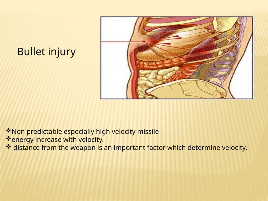 Trauma BY Dr ALI ADIL TRAUMA Trauma is the study - slide 8 of 53