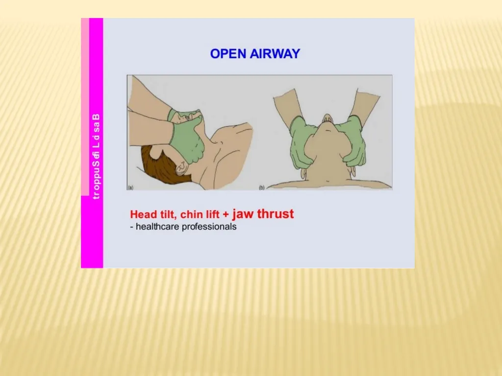 Trauma BY Dr ALI ADIL TRAUMA Trauma is the study - slide 18 of 53