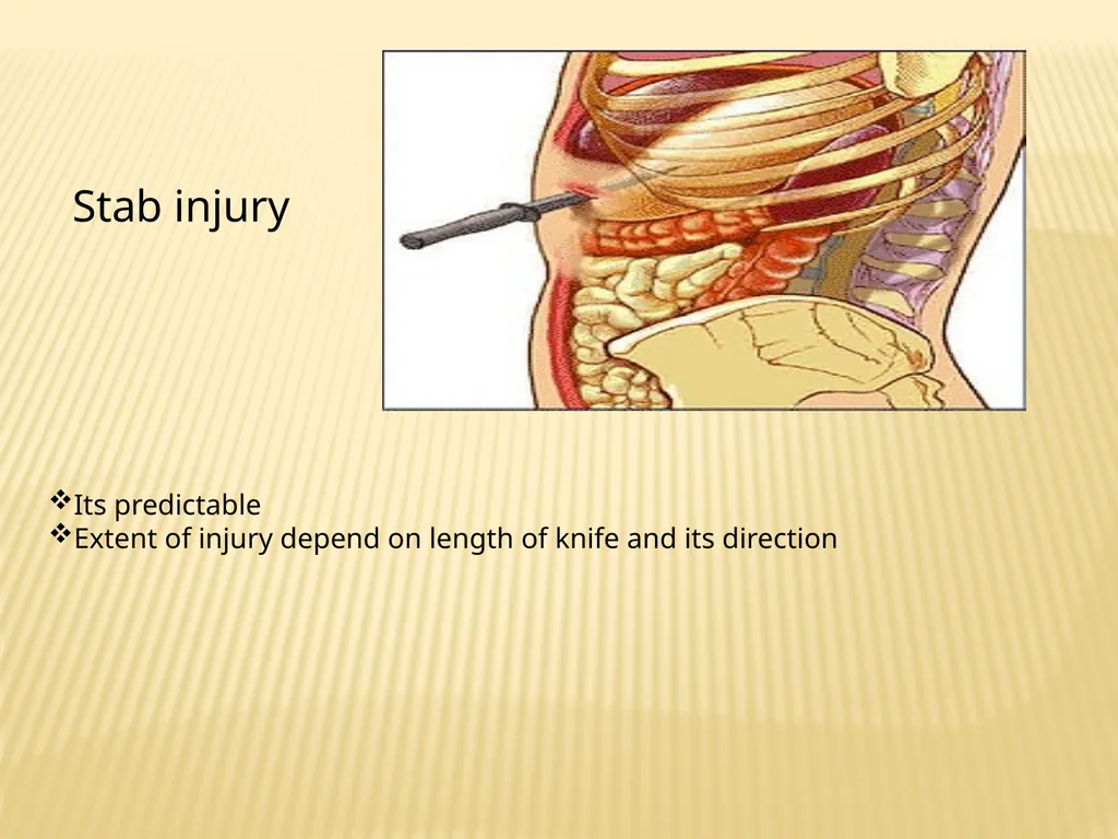 Trauma BY Dr ALI ADIL TRAUMA Trauma is the study - slide 7 of 53