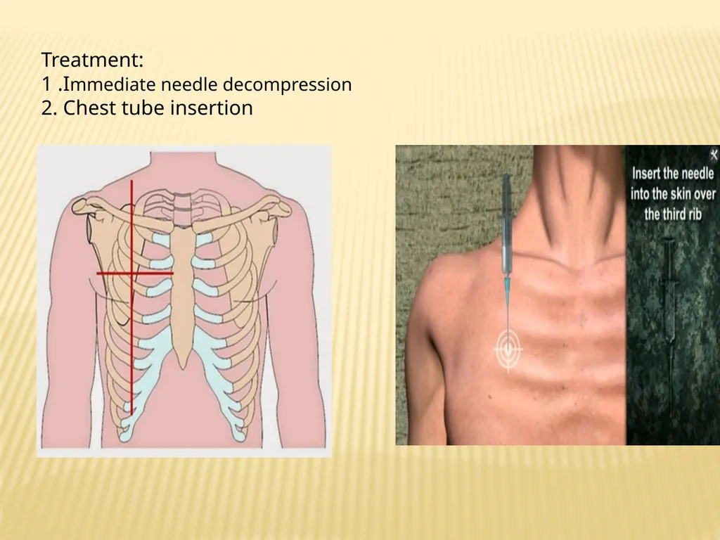 Trauma BY Dr ALI ADIL TRAUMA Trauma is the study - slide 36 of 53