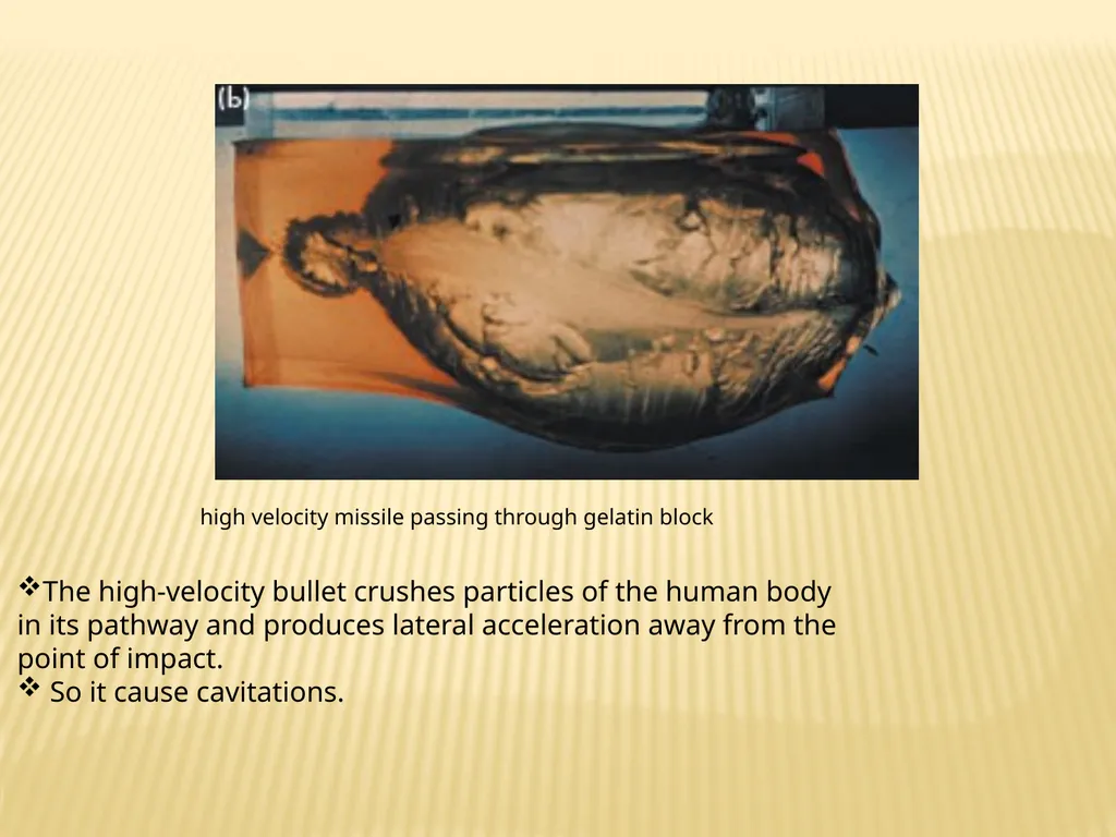 Trauma BY Dr ALI ADIL TRAUMA Trauma is the study - slide 10 of 53
