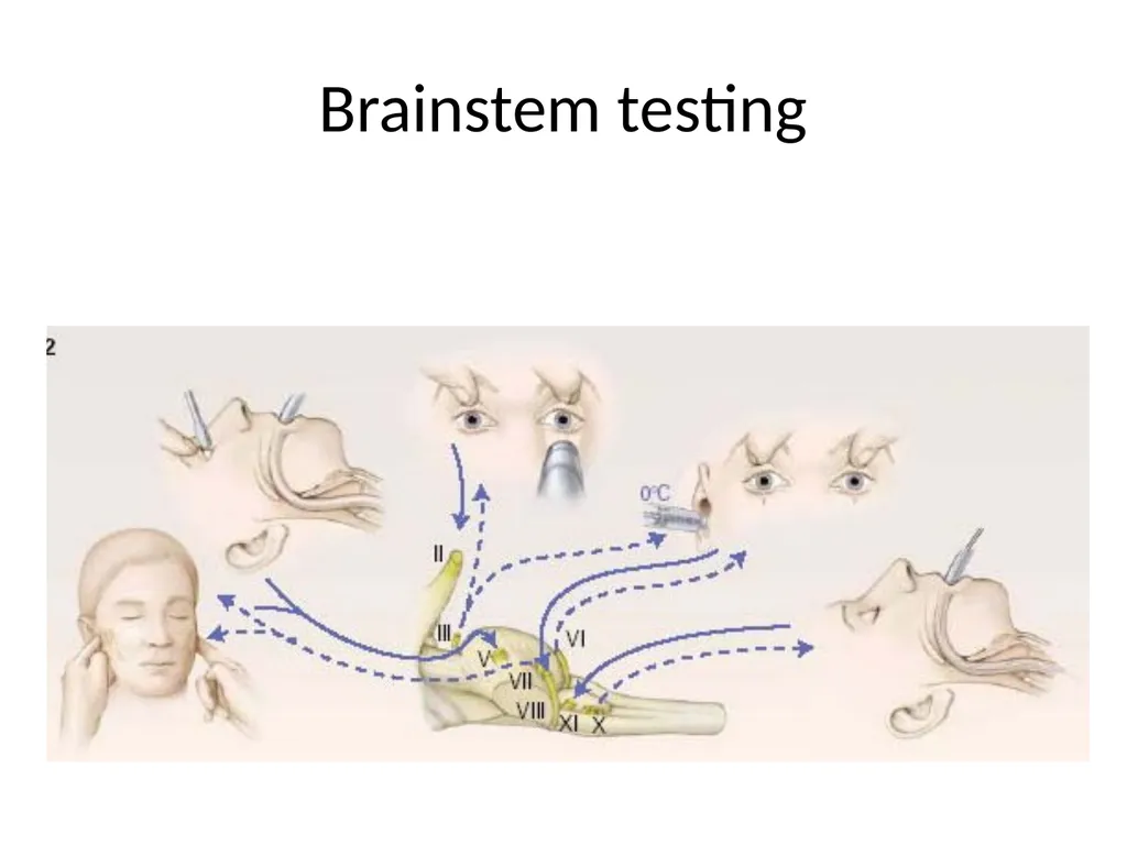Brain death declaration in children Dr Lokesh - slide 9 of 53