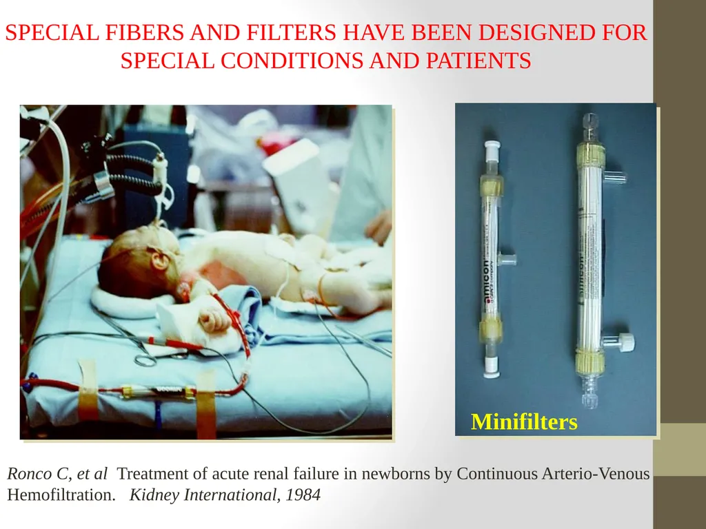 AKI and CRRT: Progress over the last 2 decades! - slide 11 of 37