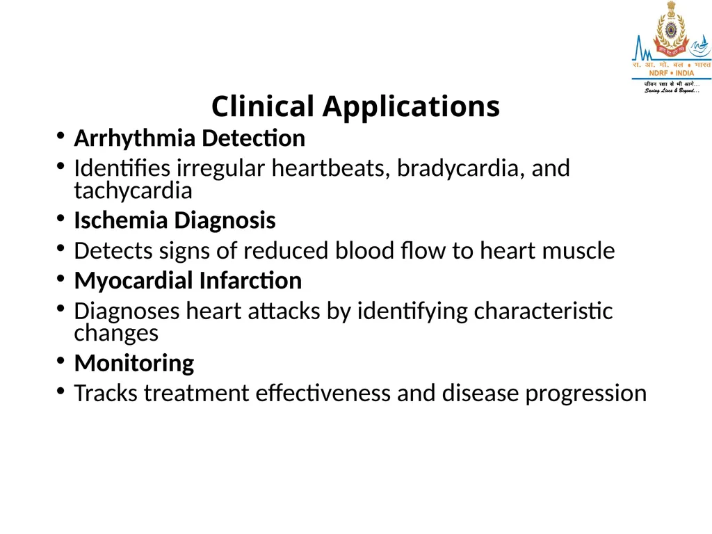 What is ECG? UNDERSTANDING ECG LESSON -2 By - slide 6 of 11