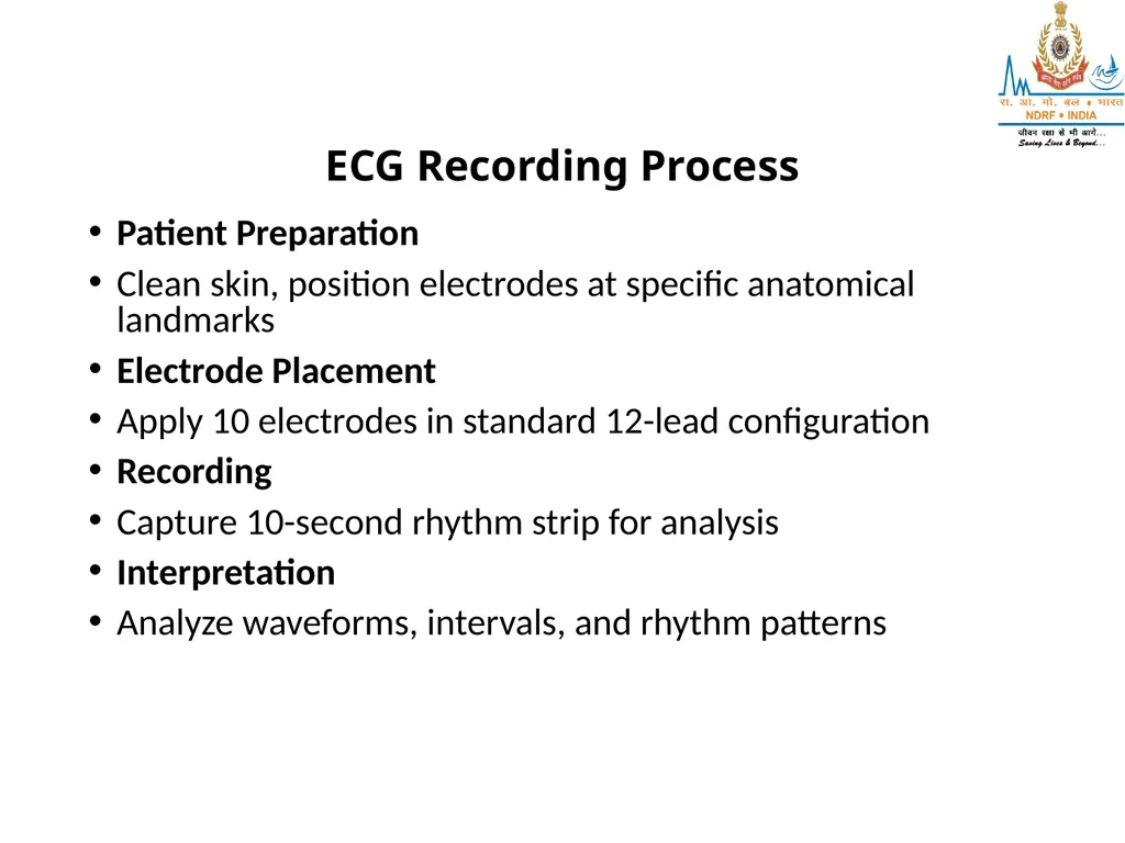 What is ECG? UNDERSTANDING ECG LESSON -2 By - slide 5 of 11