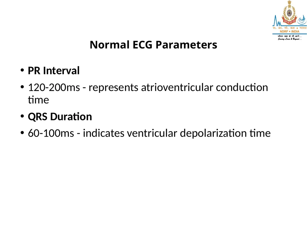 What is ECG? UNDERSTANDING ECG LESSON -2 By - slide 7 of 11