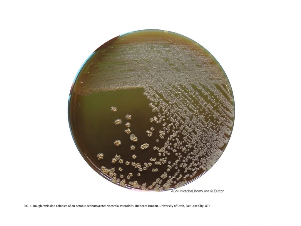 FIG. 2. Rough, wrinkled colonies of an aerobic - slide 2 of 2