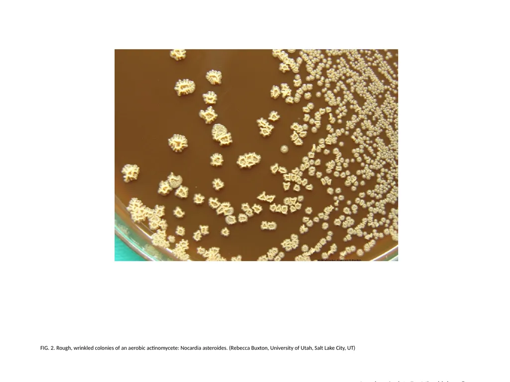FIG. 2. Rough, wrinkled colonies of an aerobic - slide 1 of 2