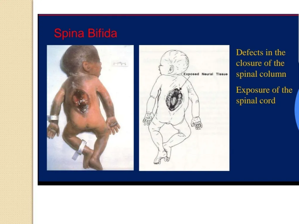 Maternal and neonatal nursing (specialties) - slide 19 of 25