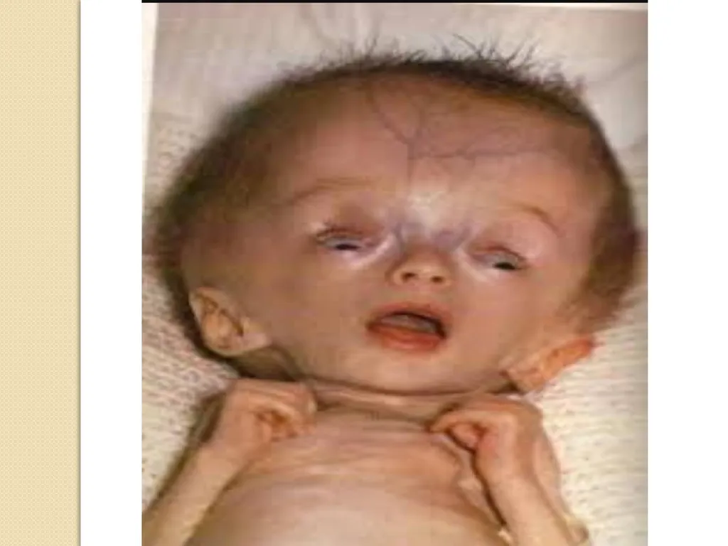 Maternal and neonatal nursing (specialties) - slide 21 of 25