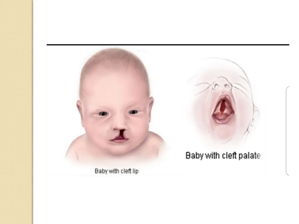 Maternal and neonatal nursing (specialties) - slide 22 of 25