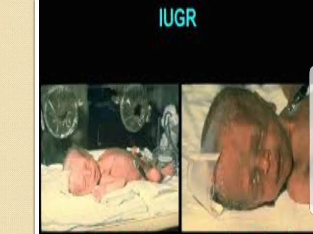 Maternal and neonatal nursing (specialties) - slide 24 of 25