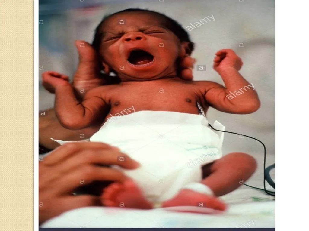 Maternal and neonatal nursing (specialties) - slide 9 of 25