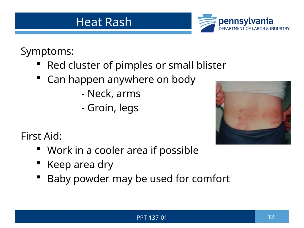 Summer Safety 1 PPT-137-01 Bureau of Workers’ - slide 12 of 29