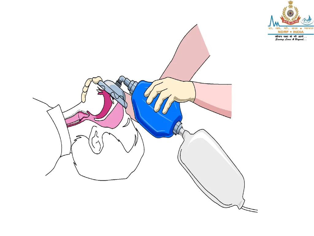 OXYGEN THERAPY LESSON -17 BY JITENDER YADAV - slide 29 of 29