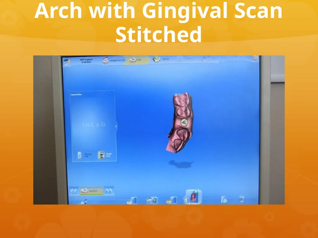 OCO Biomedical Custom Abutment and Crown With - slide 9 of 26