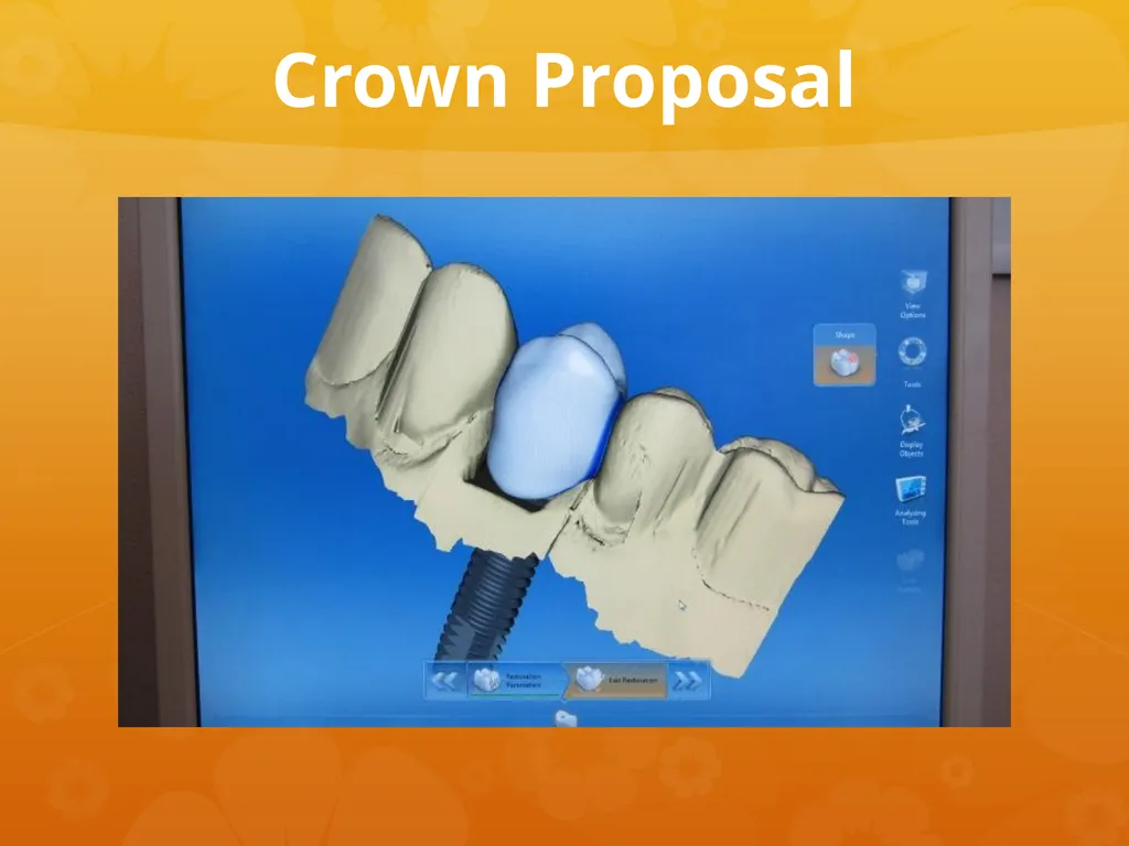 OCO Biomedical Custom Abutment and Crown With - slide 11 of 26