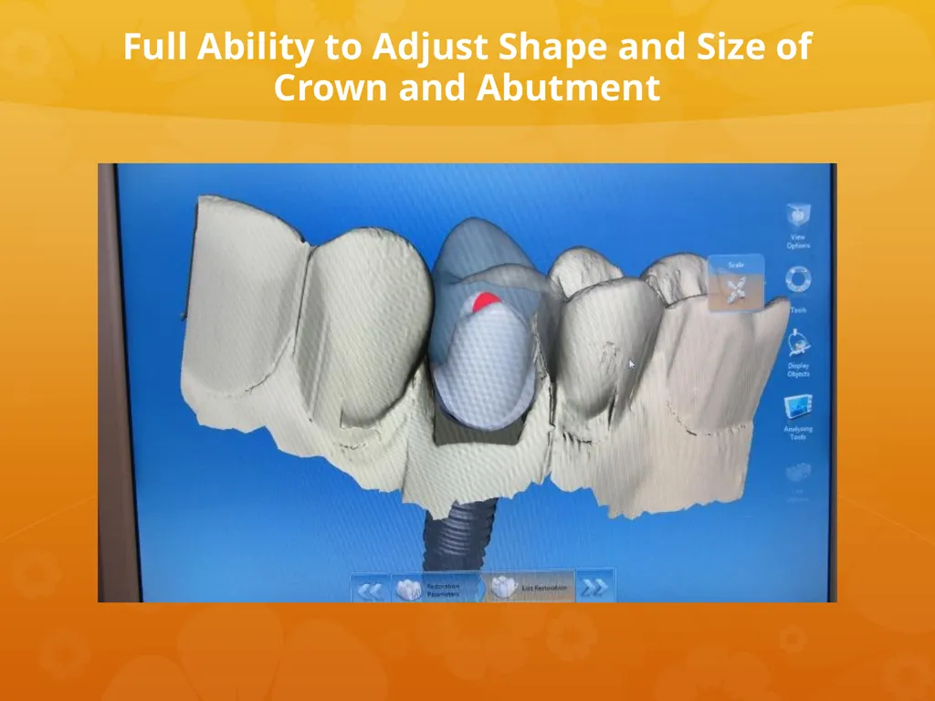 OCO Biomedical Custom Abutment and Crown With - slide 17 of 26