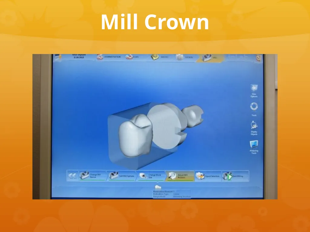 OCO Biomedical Custom Abutment and Crown With - slide 20 of 26