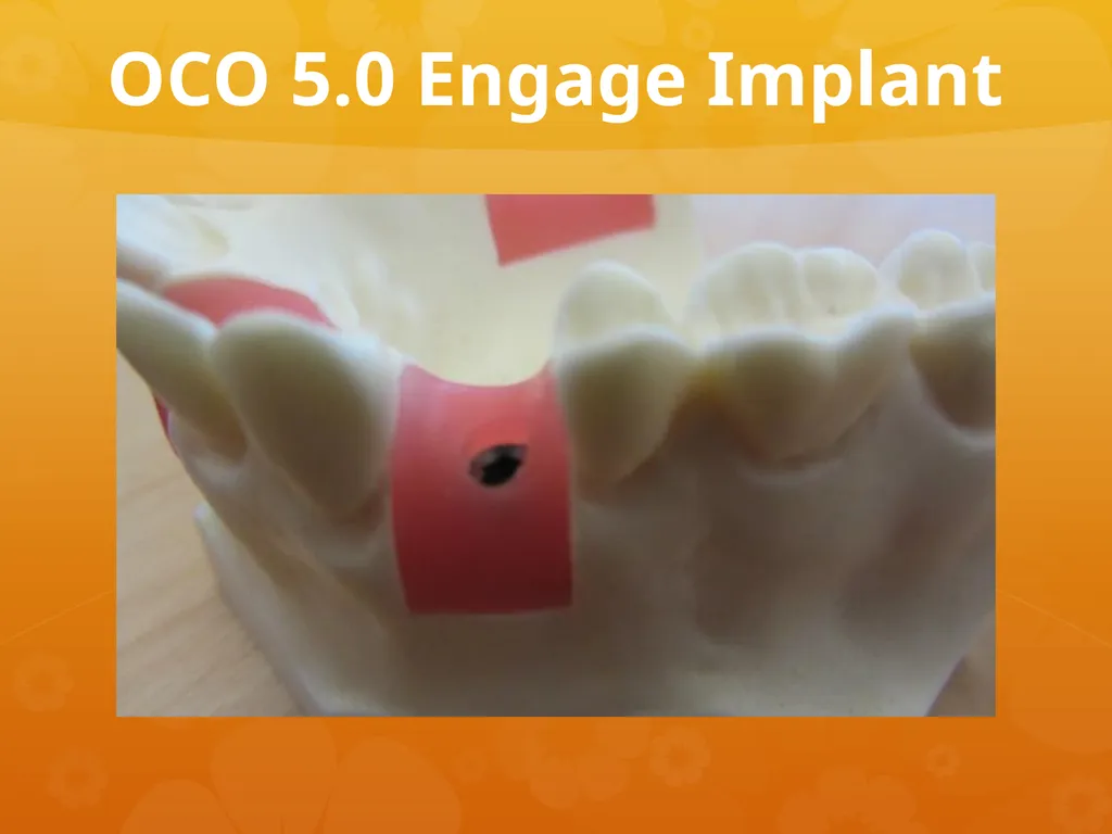 OCO Biomedical Custom Abutment and Crown With - slide 3 of 26