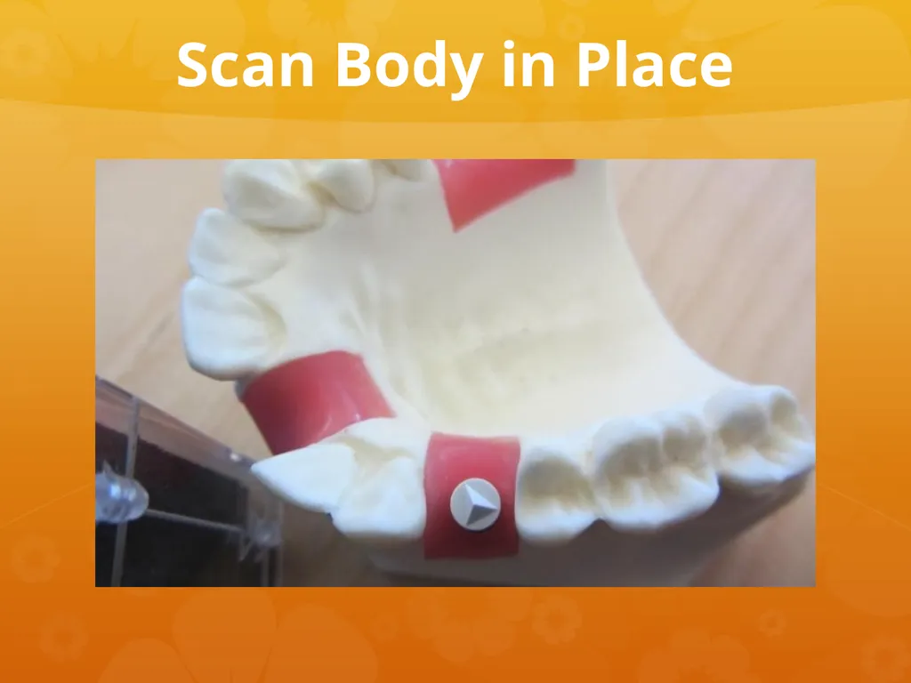 OCO Biomedical Custom Abutment and Crown With - slide 6 of 26