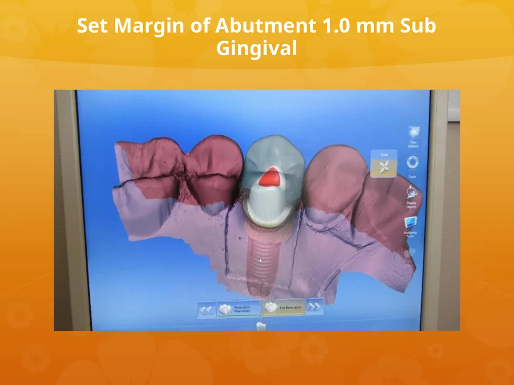 OCO Biomedical Custom Abutment and Crown With - slide 18 of 26