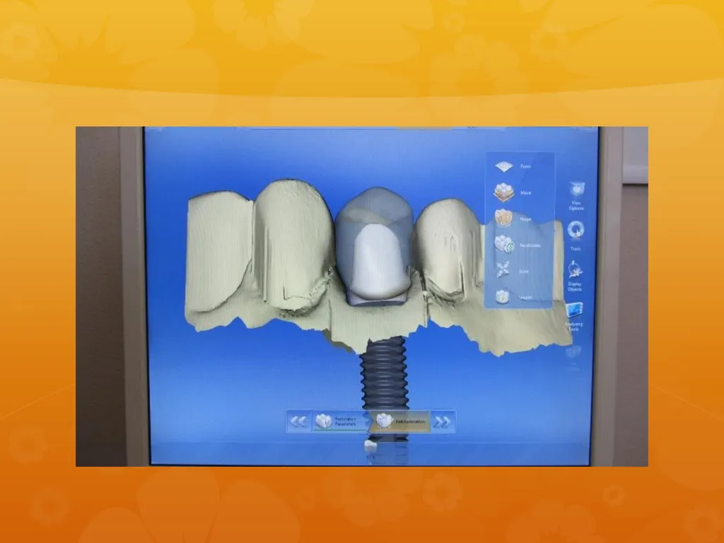 OCO Biomedical Custom Abutment and Crown With - slide 15 of 26