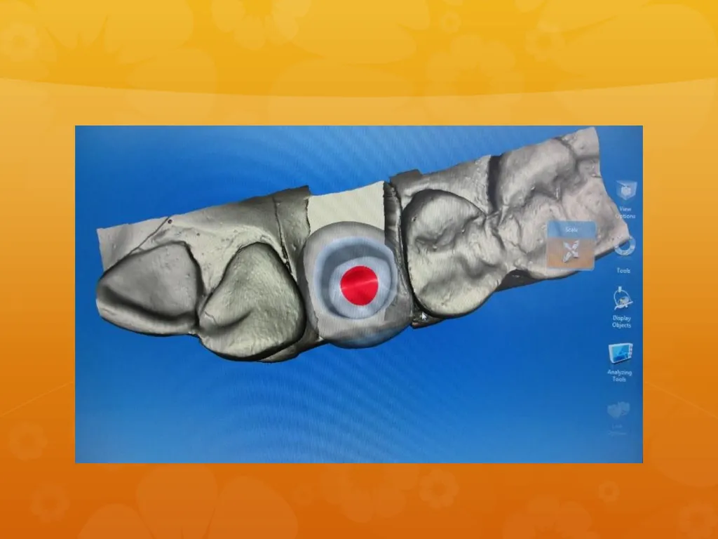 OCO Biomedical Custom Abutment and Crown With - slide 16 of 26