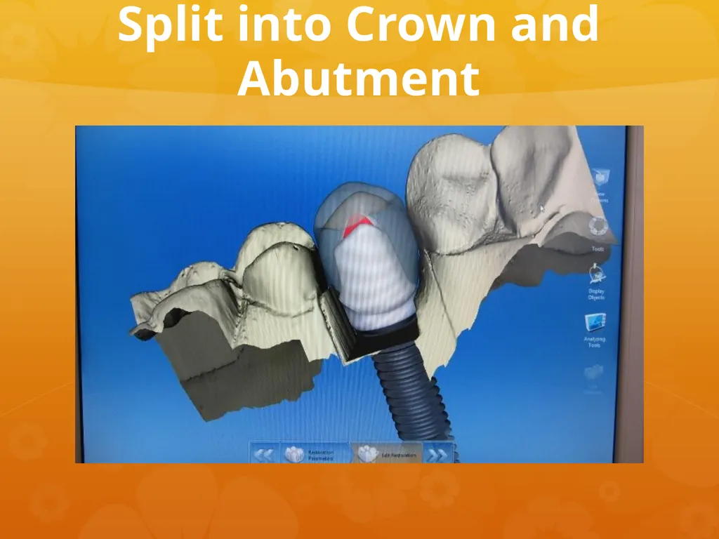 OCO Biomedical Custom Abutment and Crown With - slide 14 of 26