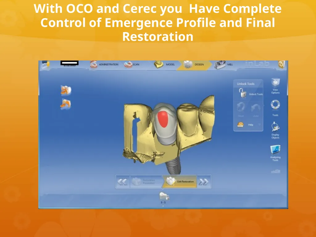 OCO Biomedical Custom Abutment and Crown With - slide 2 of 26