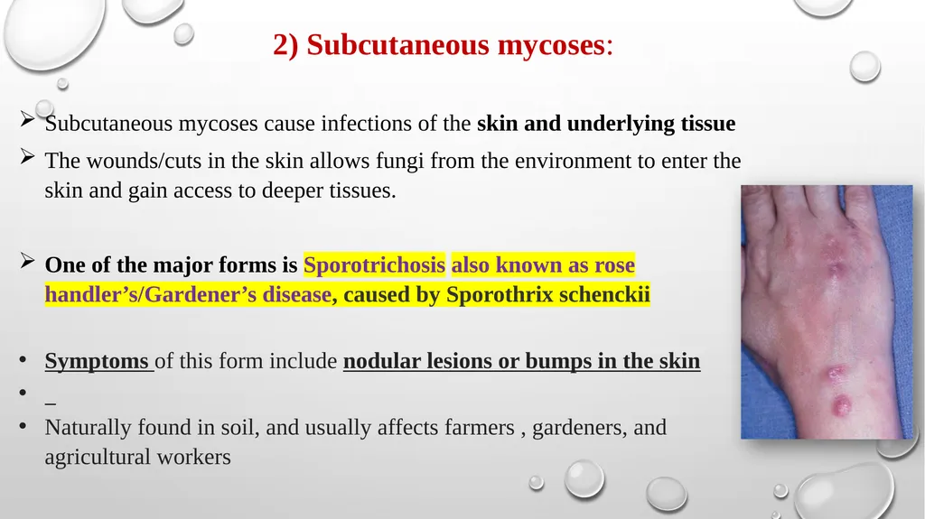 Medical Mycology Lab2 Mycosis What is Mycosis ? - slide 6 of 19