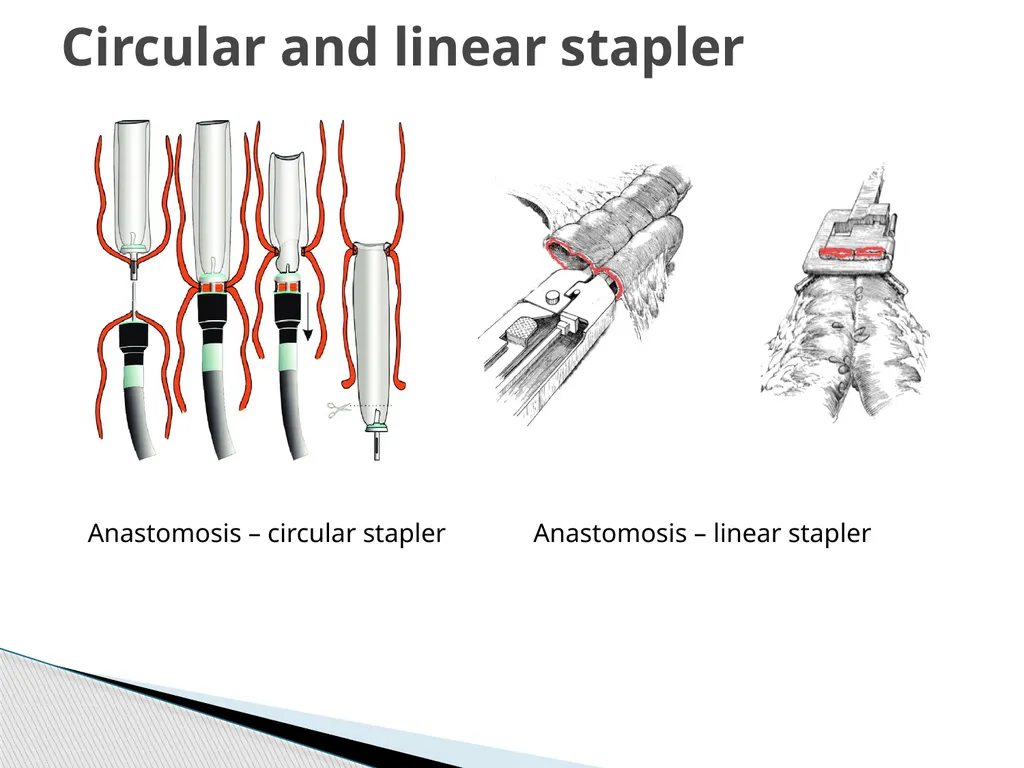 SUTURE – MATERIALS & METHODS Dr. Rudra Pratap - slide 34 of 45