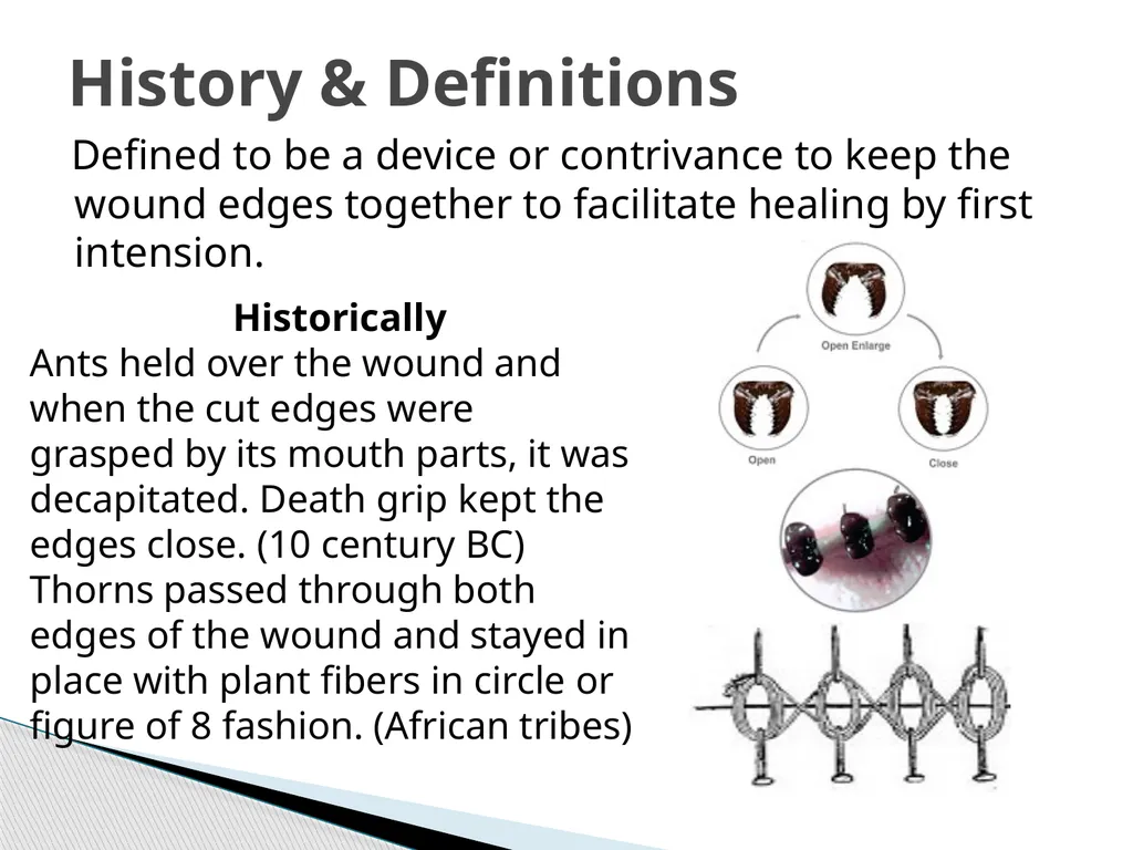 SUTURE – MATERIALS & METHODS Dr. Rudra Pratap - slide 2 of 45