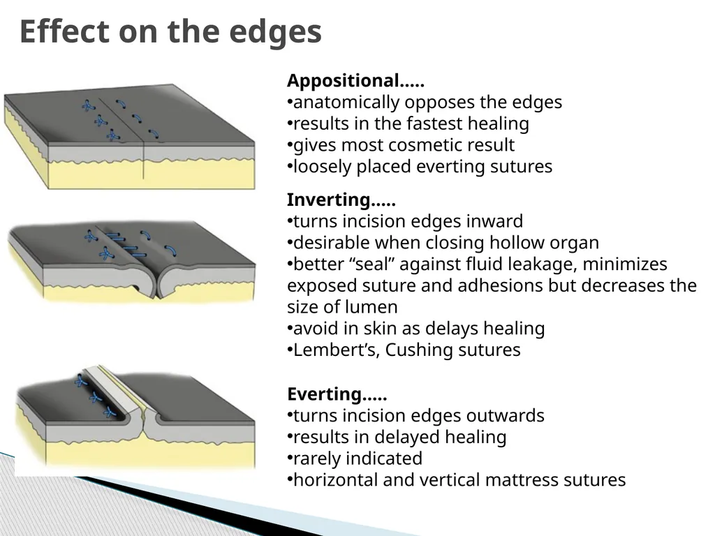SUTURE – MATERIALS & METHODS Dr. Rudra Pratap - slide 40 of 45